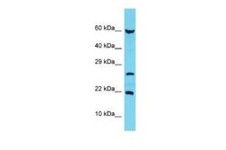 C17orf102 Rabbit anti-Human, Polyclonal, Novus Biologicals 100 &mu;g; Unconjugated:Antibodies,